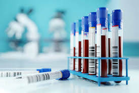 Hundreds of Blood Samples Lost in Transit by Courier: Patients, Staff Raise Concerns Over Lab Cuts in New Zealand